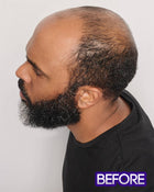 Dignified | Average/Large Men's Lace Front & Monofilament Top Synthetic Wig by HIM